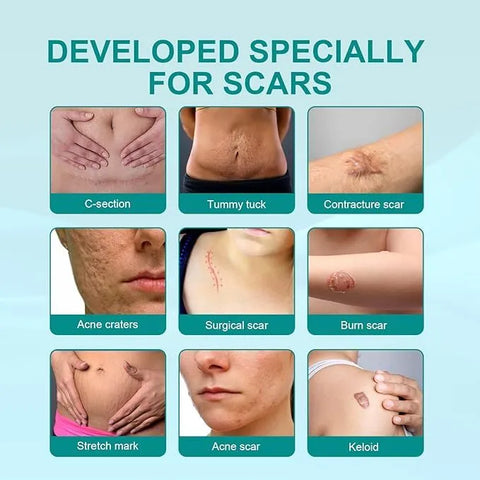 Medical Scar Removal Spray